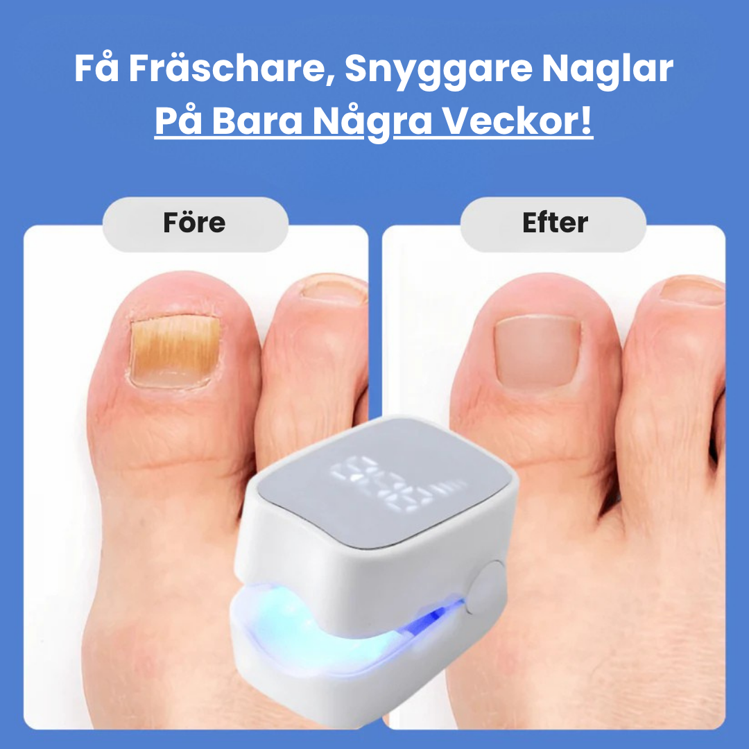 NailClear™ – Återfå fräscha, rena naglar utan starka kemikalier!