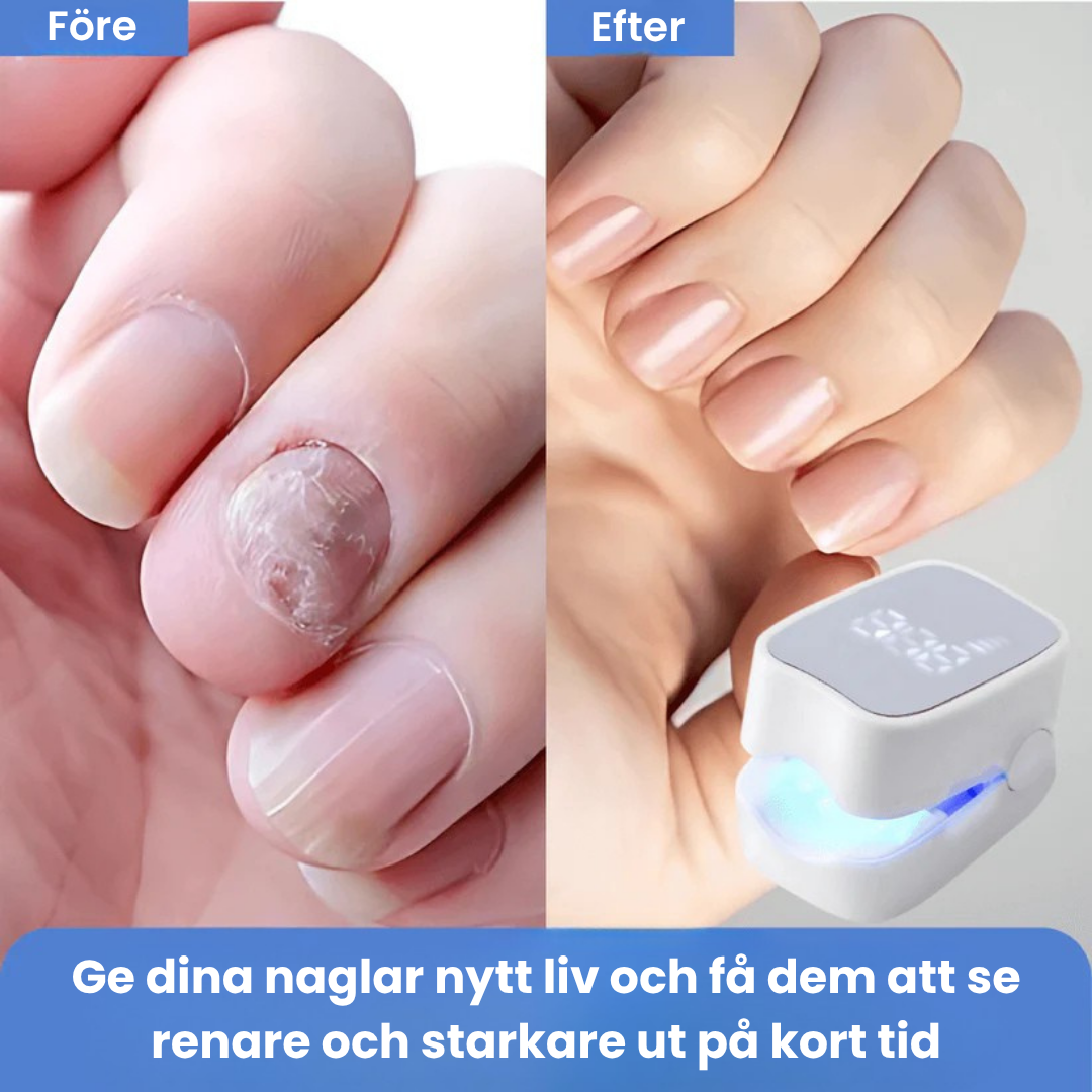 NailClear™ – Återfå fräscha, rena naglar utan starka kemikalier!