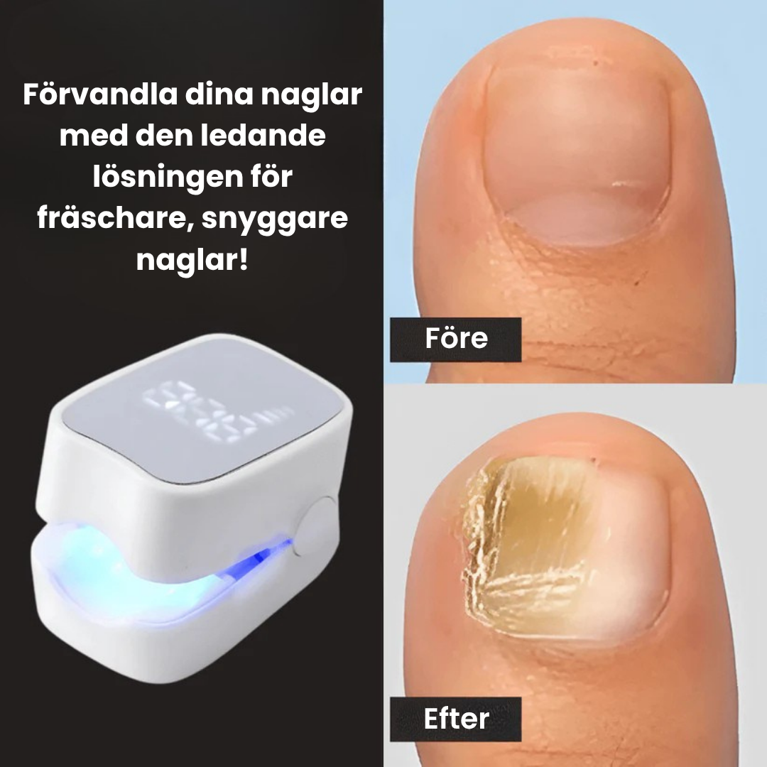 NailClear™ – Återfå fräscha, rena naglar utan starka kemikalier!